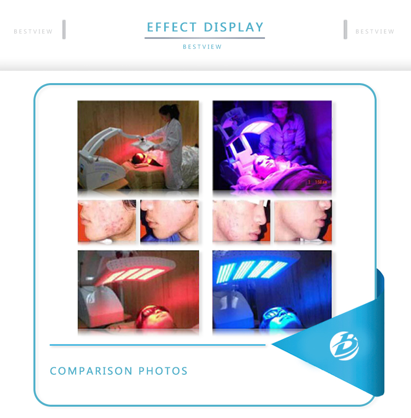 BESTVIEW-Professional medical beauty equipment specialist