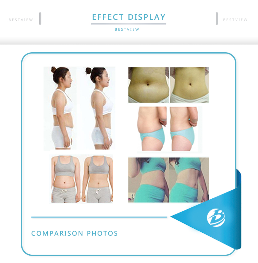 BESTVIEW-Professional medical beauty equipment specialist