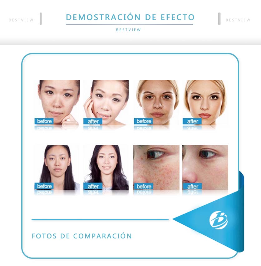BESTVIEW Medical and Beauty Equipment CO., LTD. 
