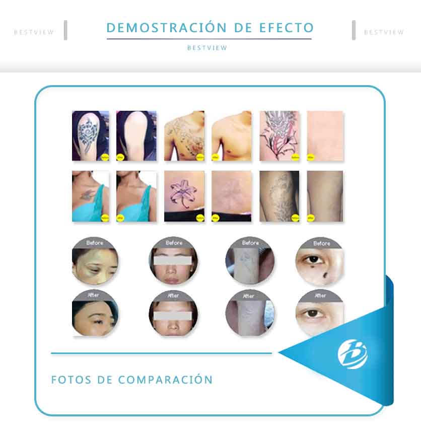 BESTVIEW Medical and Beauty Equipment CO., LTD. 