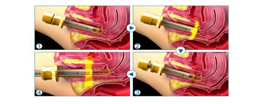 BESTVIEW Medical and Beauty Equipment CO., LTD. 