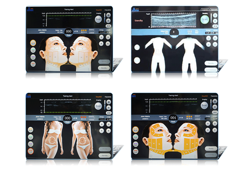 BESTVIEW Medical and Beauty Equipment CO., LTD. 