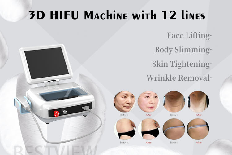 3D HIFU machine