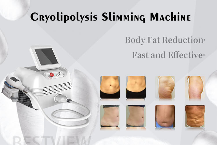   Body Slimming Cyolipolisis Machine