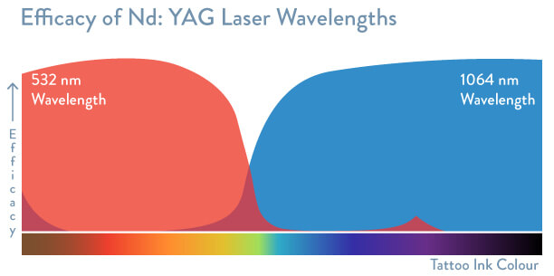 nd yag tattoo removal machine