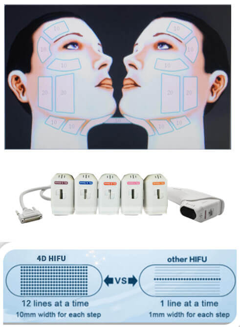 4D HIFU Machine