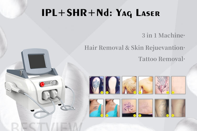 professional laser hair removal machine