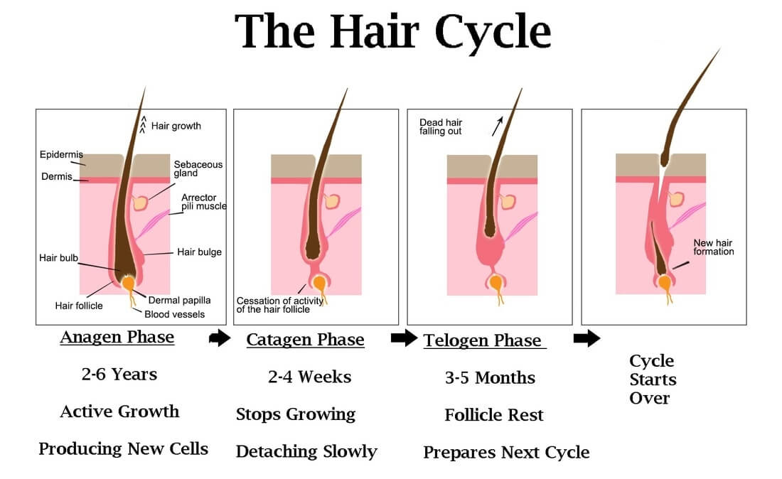 laser hair removal