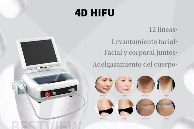 4D HIFU machine