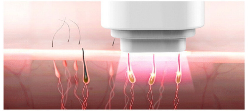 diode laser