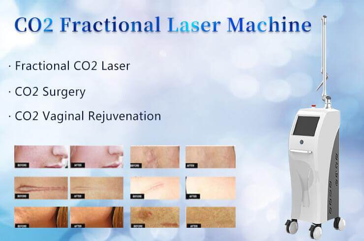 co2 fractional laser machine