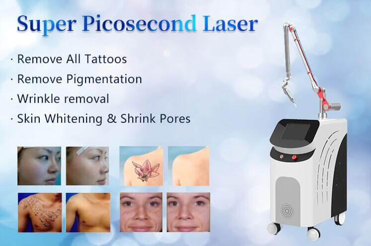 super picosecond laser machine