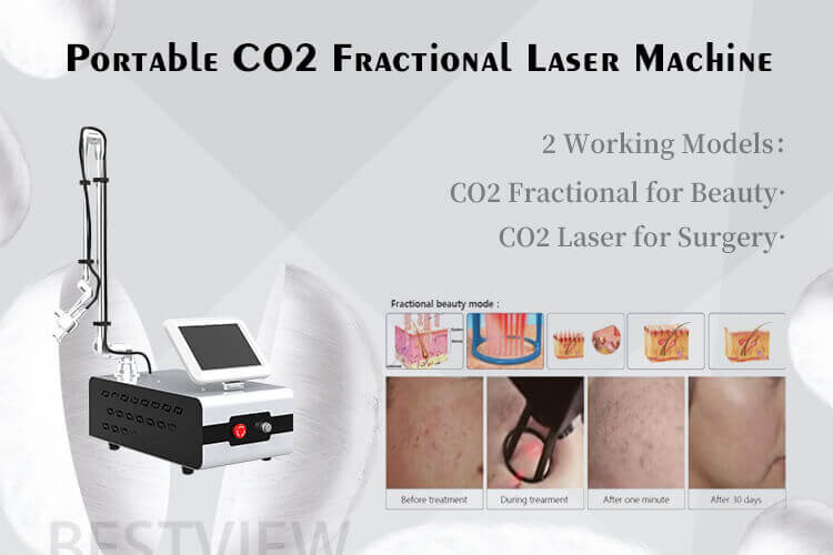 fractional co2 laser machine for sale