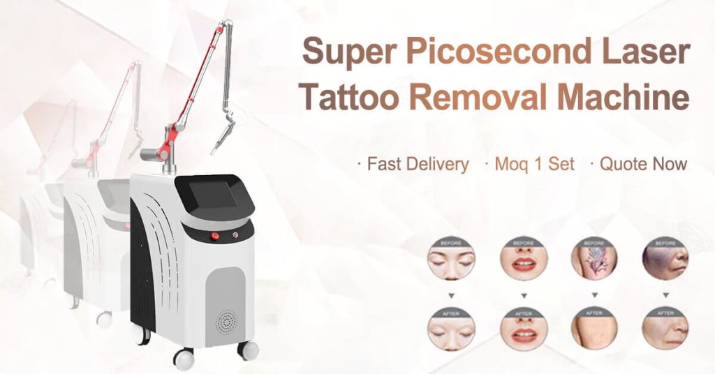 pico laser tattoo removal machine cost
