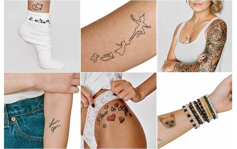 laser tattoo removal machine 