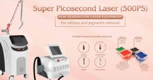 picosecond laser tattoo removal machine