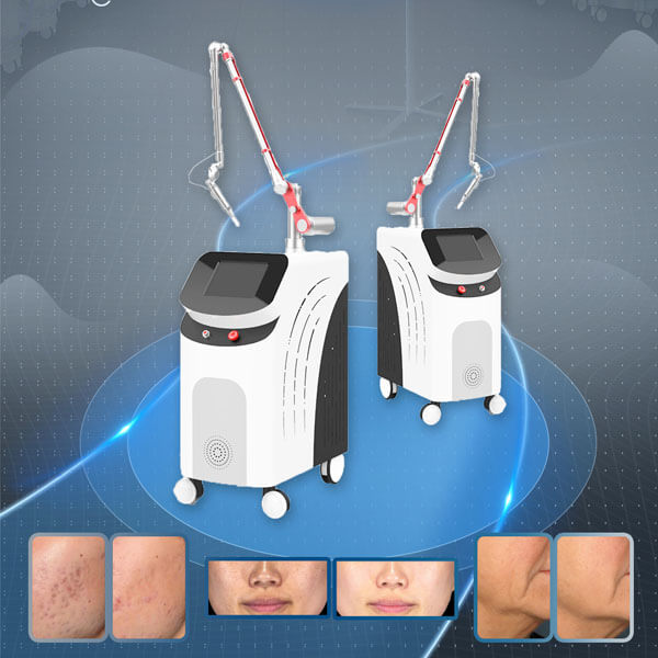 Best Picosecond Laser Tattoo Removal Machine For Your Choice