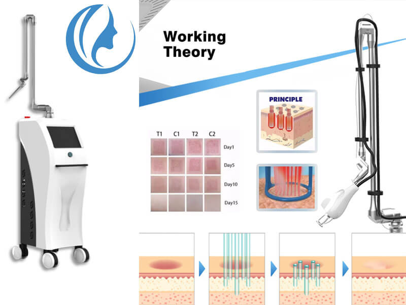 co2 fractional laser machine for sale