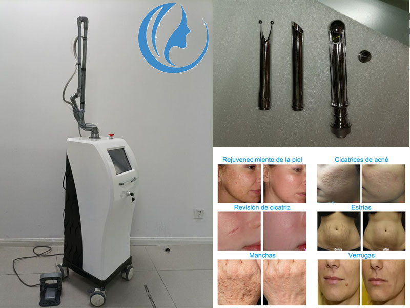 fractional laser resurfacing machine