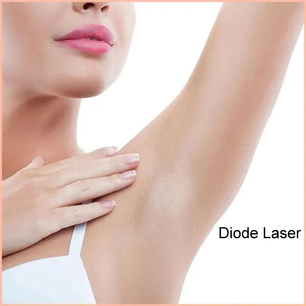 Do you know about laser hair removal?