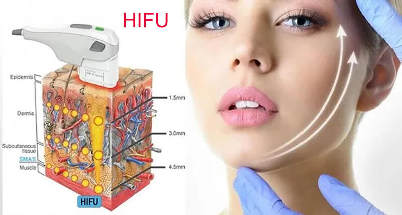 hifu treatment machine