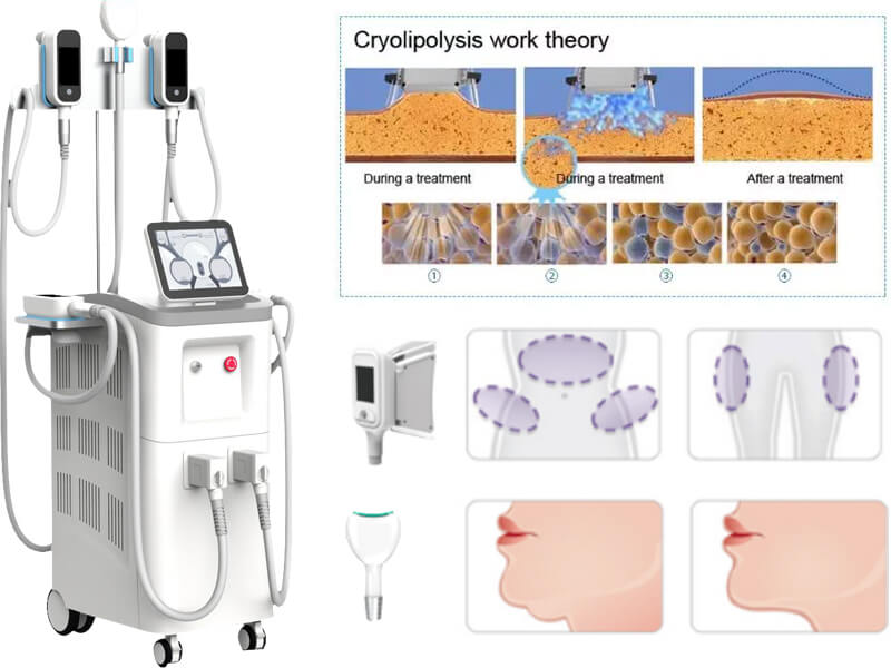 cryolipolysis slim beauty machine