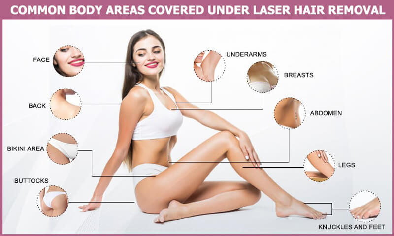 laser hair removal treatment 