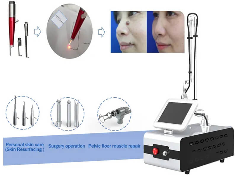 co2 fractional laser machine