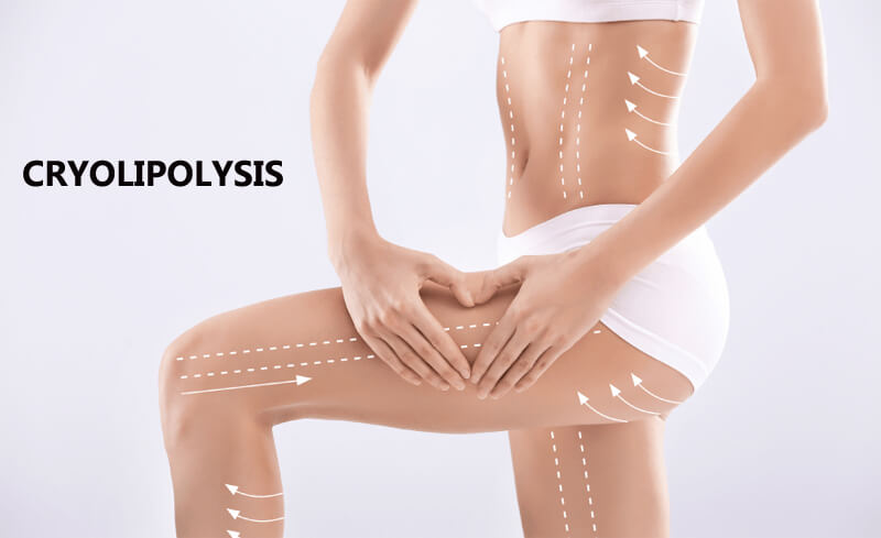 cryolipolysis slimming machine