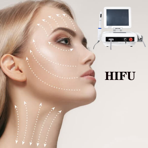 HIFU ultrasound face lifting treatment principles and safety