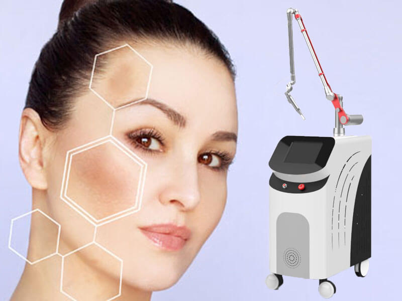 picosecond laser tattoo removal machine