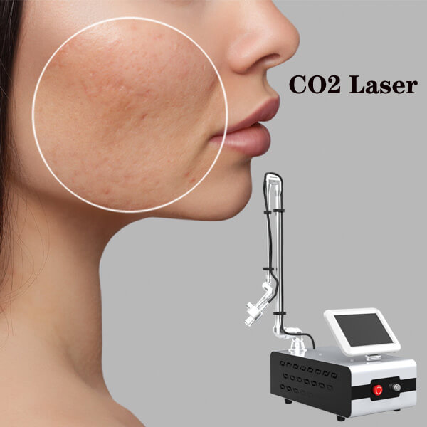CO2 fractional laser facial treatment range