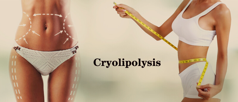 cryolipolysis slimming 