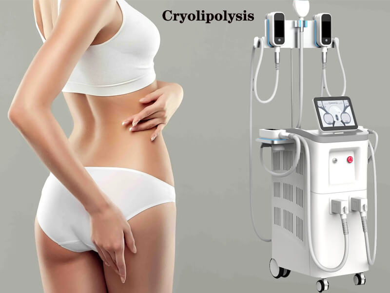 cryolipolysis fat freezing machine