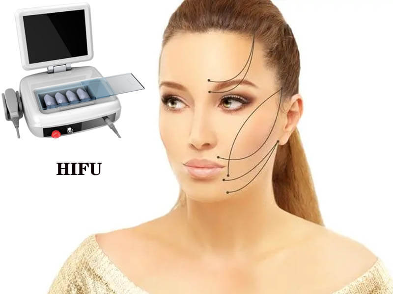 hifu skin tightening machine