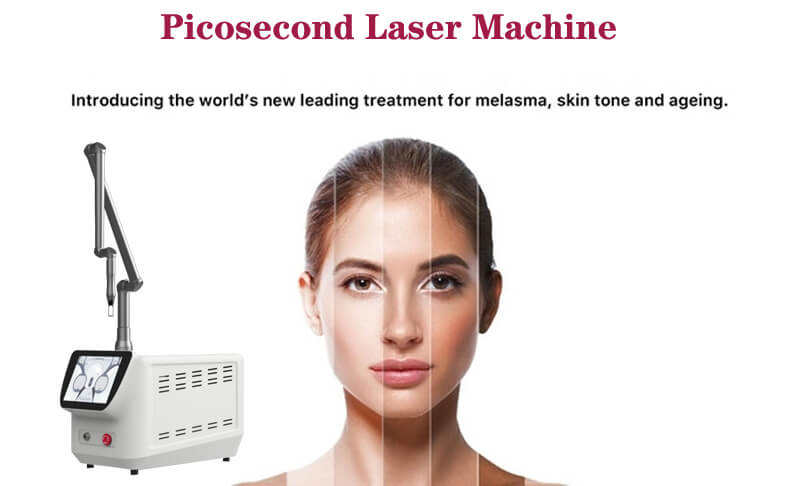 picosecond laser tattoo removal machine