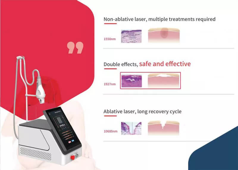 thulium laser machine