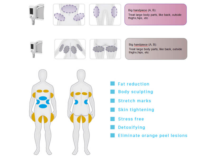 cryolipolysis slimming machine