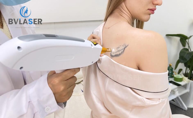 nd yag laser machine treatment