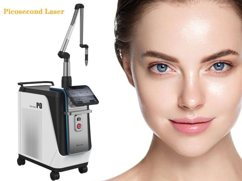 picosecond laser tattoo removal machine