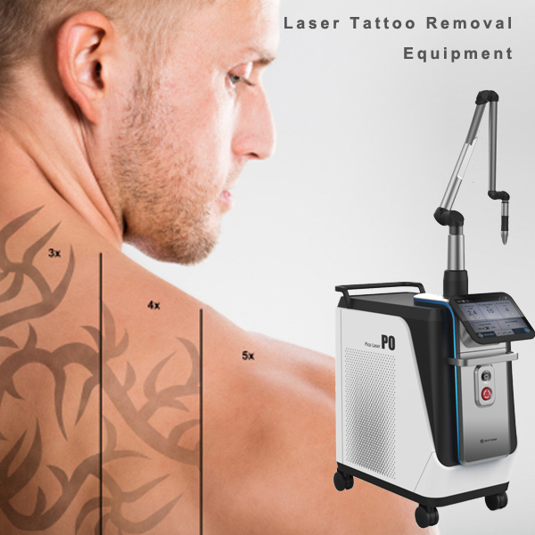The choice of the best laser tattoo removal machine