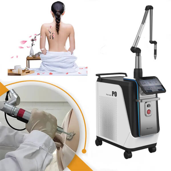 What Is The Safe and Effective Laser Tattoo Removal Machine?