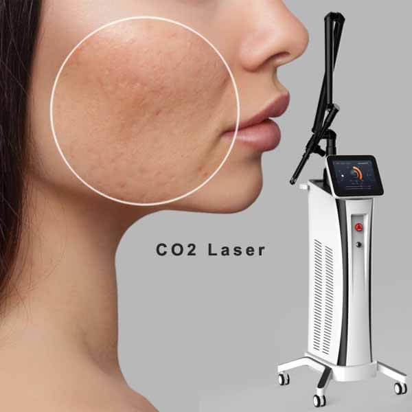 CO2 fractional laser machine advantages compared to other skin resurfacing treatment