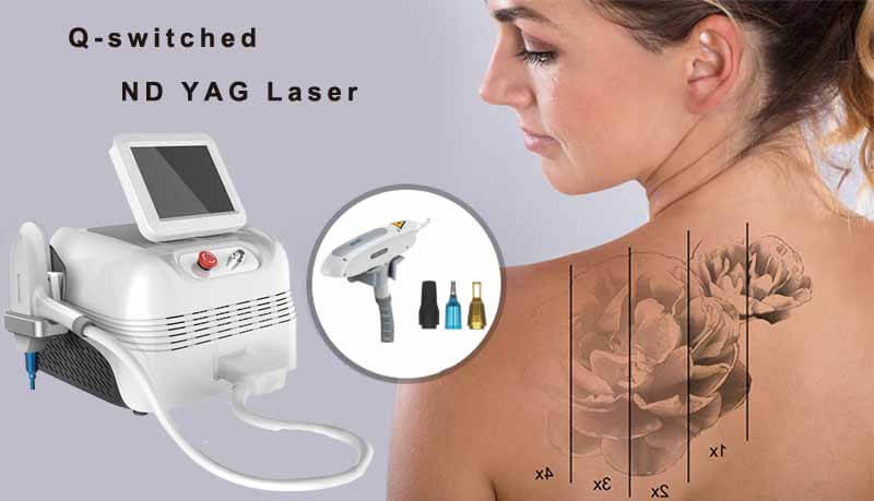 nd yag laser machine for sale