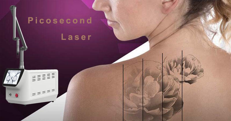 picosecond laser tattoo removal machine