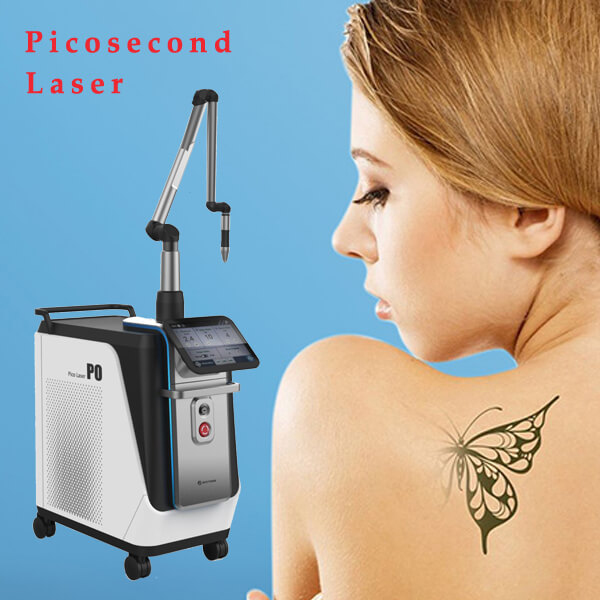 What is the success rate of laser tattoo removal treatment?
