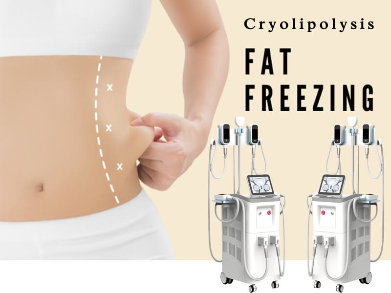 cryolipolysis fat freezing machine