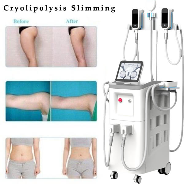 Are there any side effects of using a cryolipolysis machine treatment