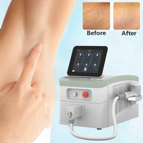 Is diode laser hair removal machine treatment permanent