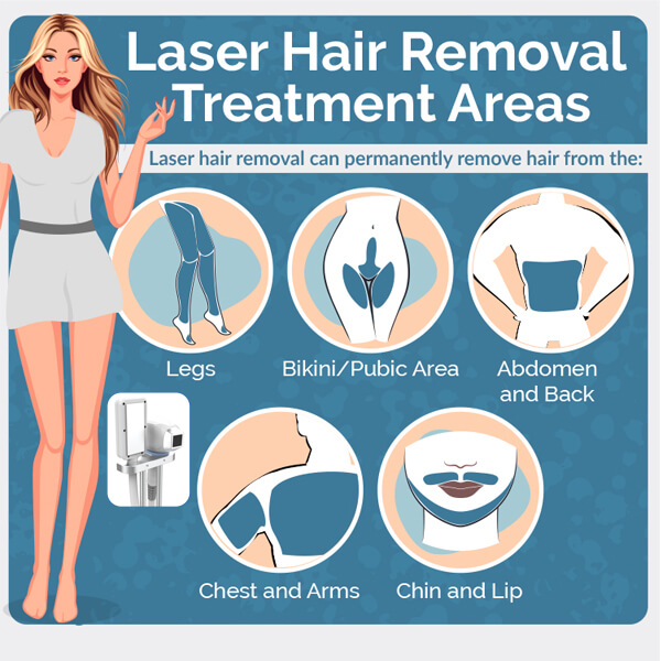 What should avoid before and after a laser hair removal treatment?